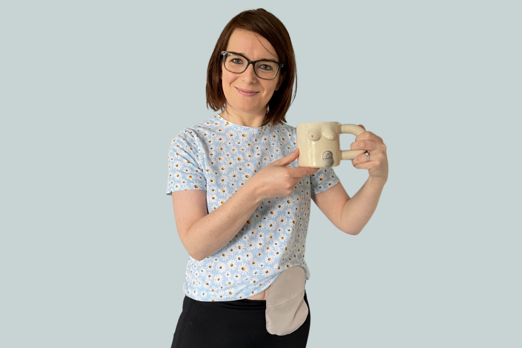 A woman with brown hair smiles and holds her stoma up to the camera.