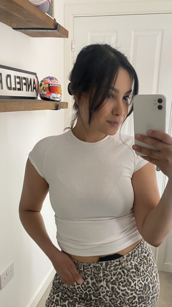 A brunette woman poses in a white t-shirt and patterned trousers, with her stoma bag peeking out.