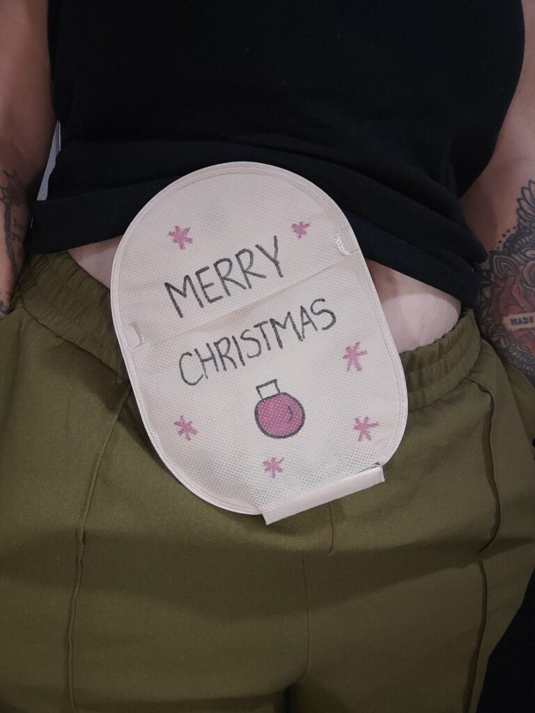 A close up of a woman wearing a stoma bag, with a pink bauble and stars, and text saying "Merry Christmas"