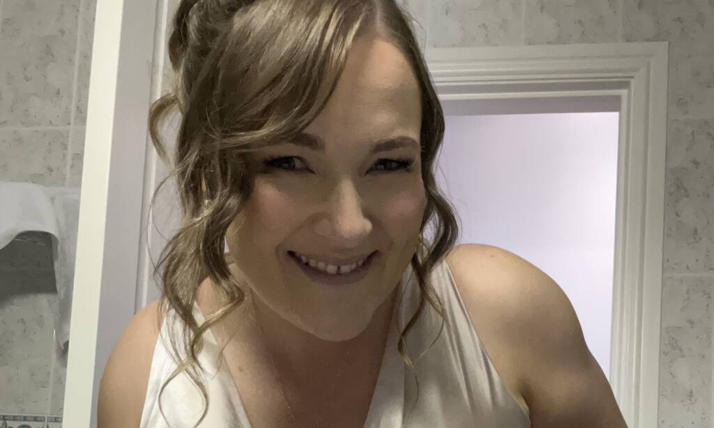 Brown-haired woman smiles as she pulls up her wedding dress to show her ostomy bag